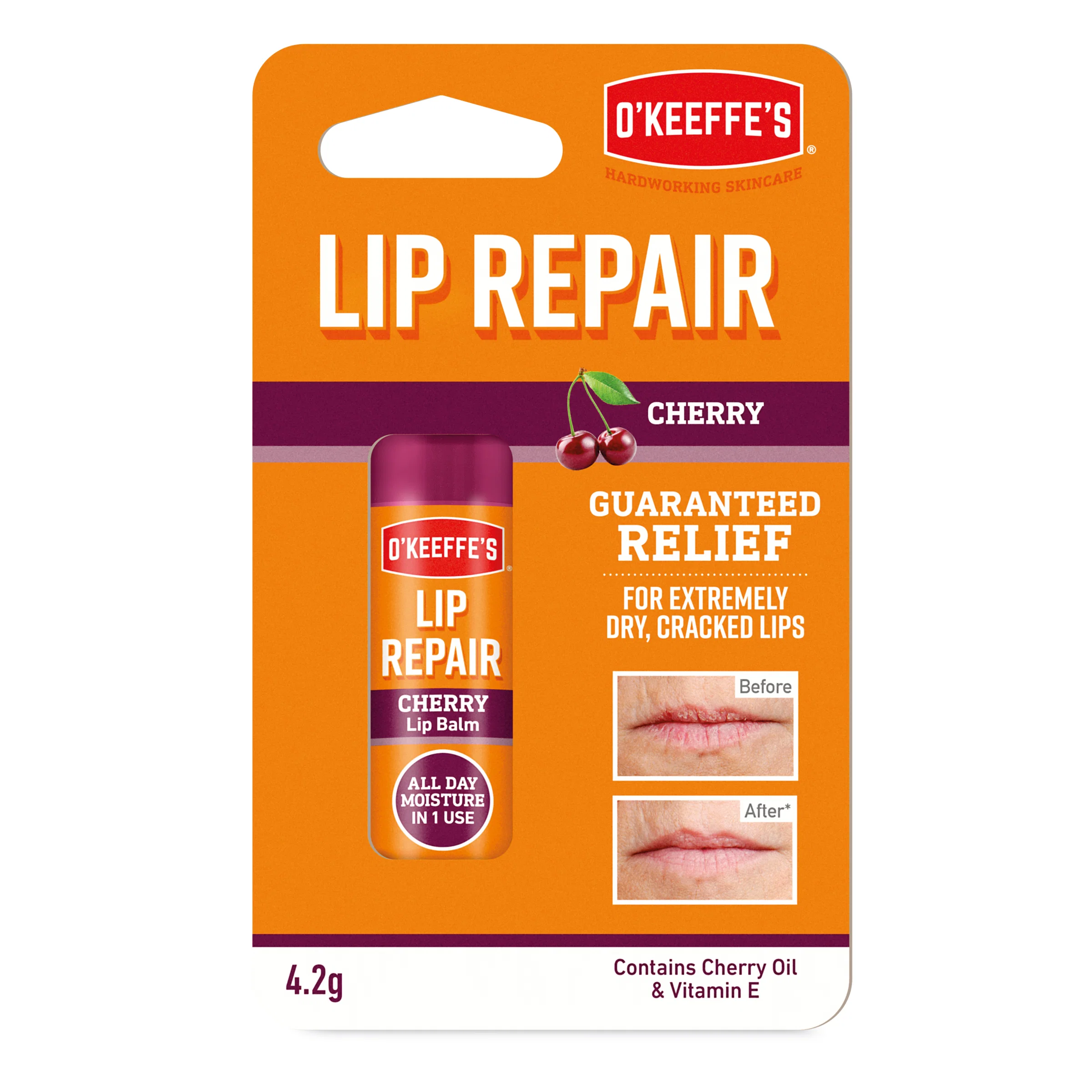 Lip Repair varasalvi